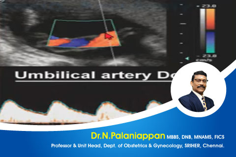 Gestational Hypertension PIH Pregnancy Induced Hypertension