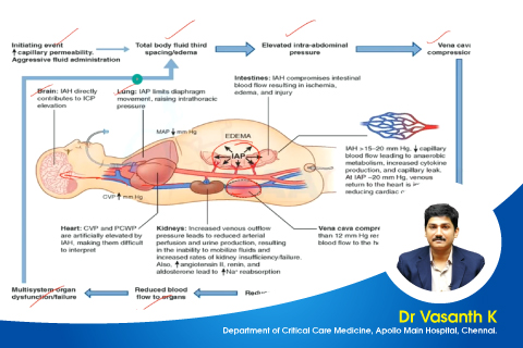 Abdominal Compartment Syndrome