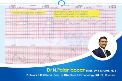 Intrapartum fetal monitoring Have We Done With CTG