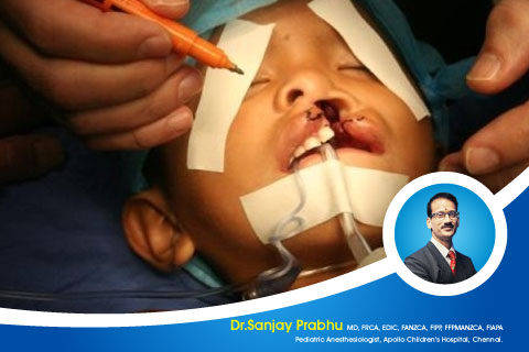Anesthesia for cleft lip and palate