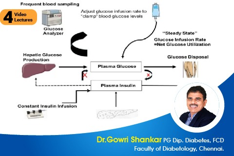 Pathophysiology of type II diabetes